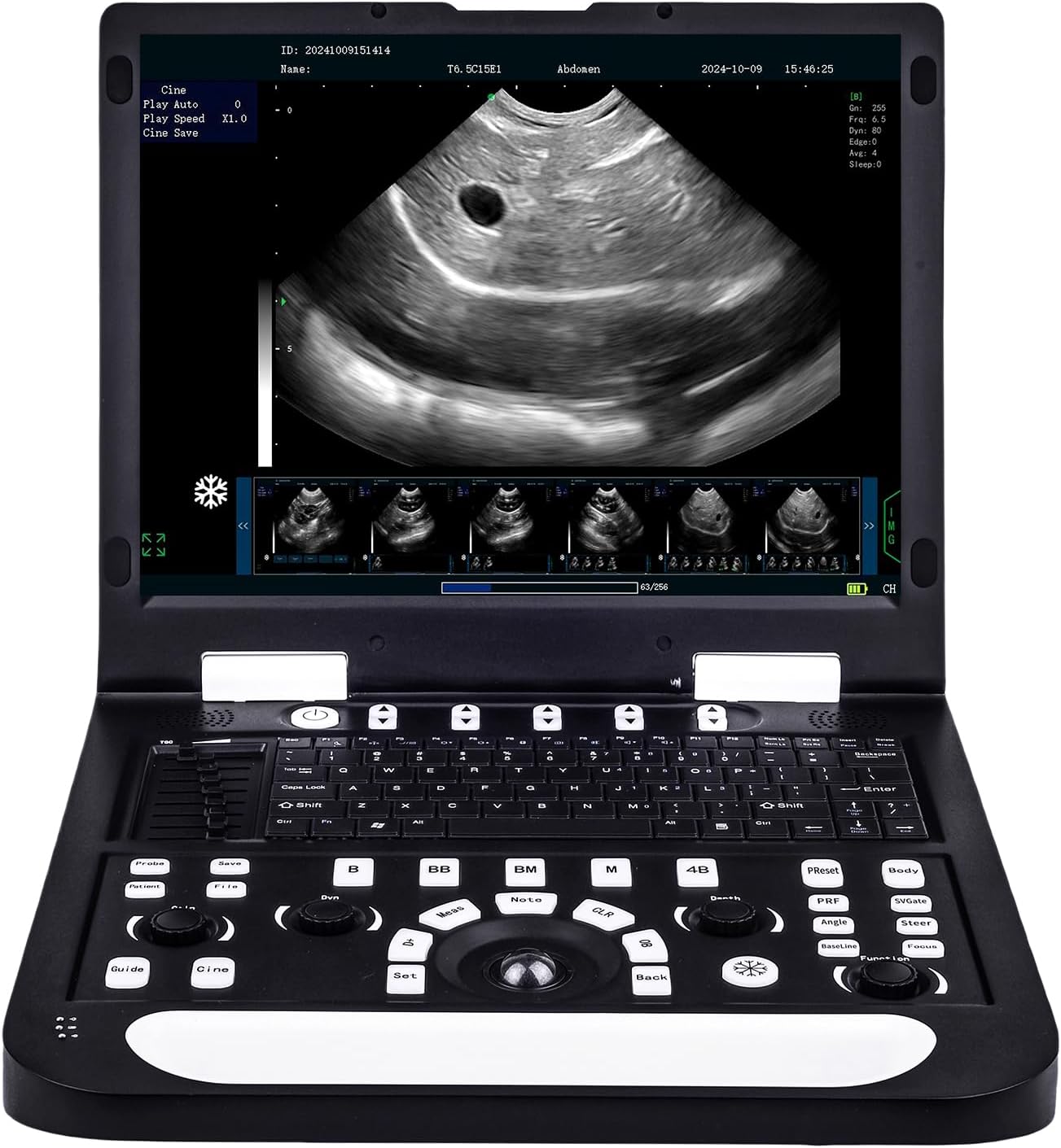 Image 1 of buy sunbesta n60 veterinary ultrasound