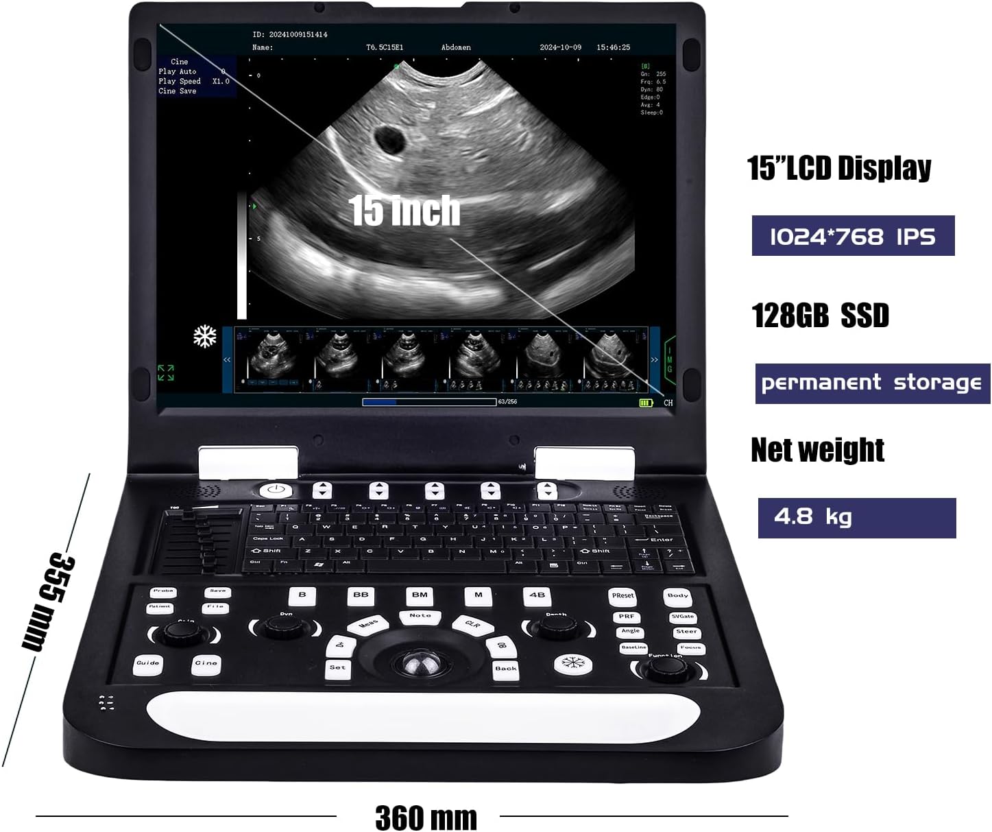 buy sunbesta n60 veterinary ultrasound,sunbesta n60 ultrasound worth buying,sunbesta n60 vs other veterinary ultrasound,best portable ultrasound for dogs and cats,sunbesta n60 pros cons for cattle,should i buy sunbesta n60 for horse pregnancy check unboxing and complete package contents