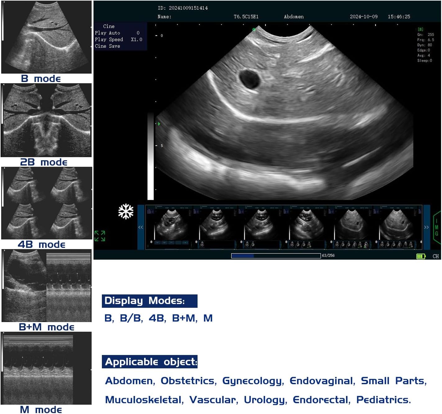 buy sunbesta n60 veterinary ultrasound,sunbesta n60 ultrasound worth buying,sunbesta n60 vs other veterinary ultrasound,best portable ultrasound for dogs and cats,sunbesta n60 pros cons for cattle,should i buy sunbesta n60 for horse pregnancy check performance testing and real-world results